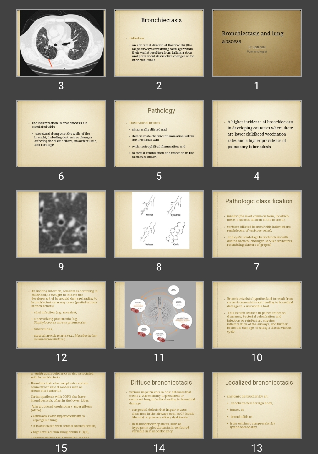 پاورپوینت آبسه و برونشکتازی Bronchiectasis and lung abscess