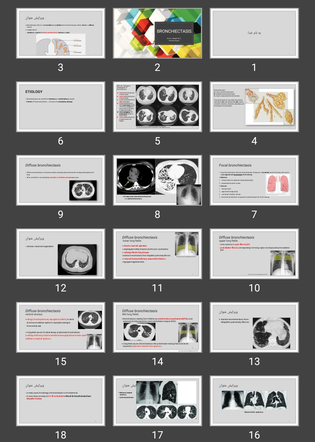 پاورپوینت برونشکتازی Bronchiectasis