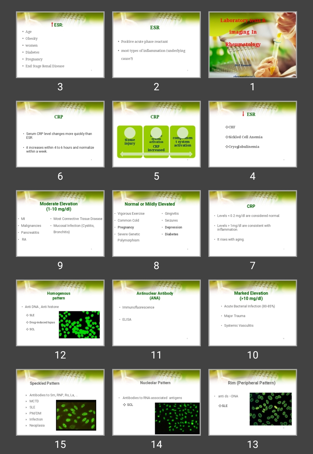 پاورپوینت تست های آزمایشگاهی Laboratory tests & imaging In Rheumatology