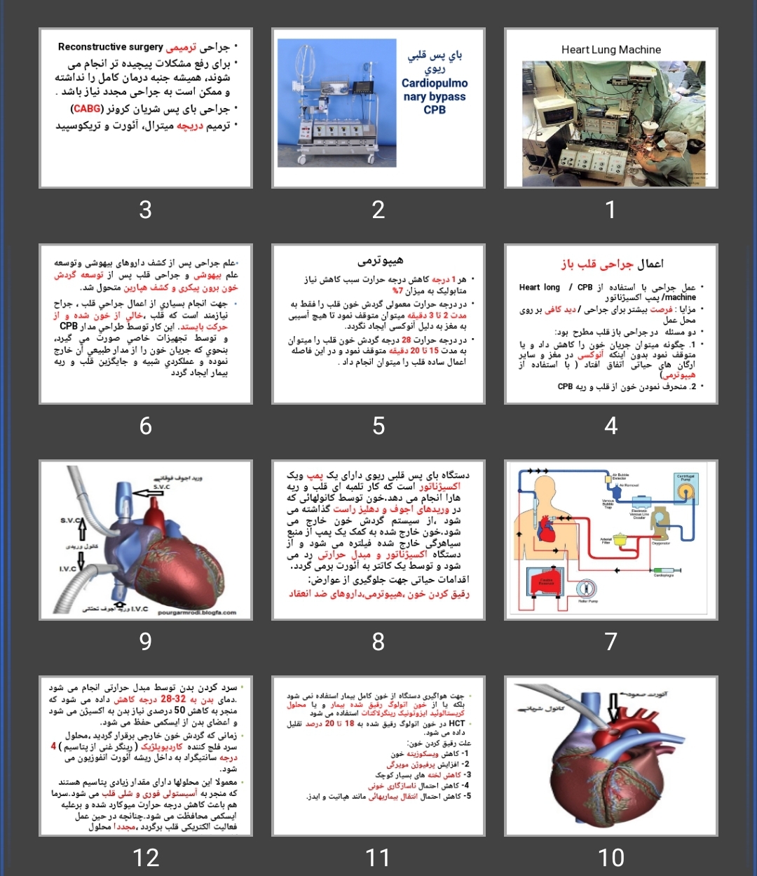 پاورپوینت جراحی قلب Heart Lung Machine