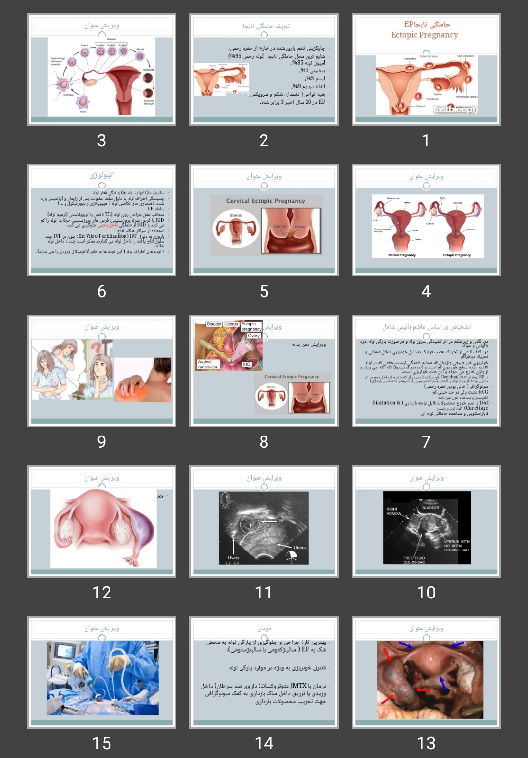 پاورپوینت حاملگی نابجا EP Ectopic Pregnancy