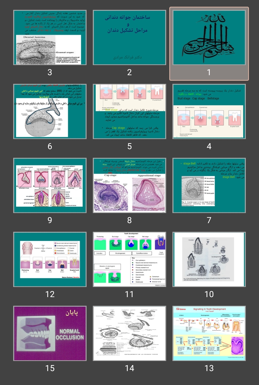 پاورپوینت ساختمان جوانه دندانی و مراحل تشکیل دندان
