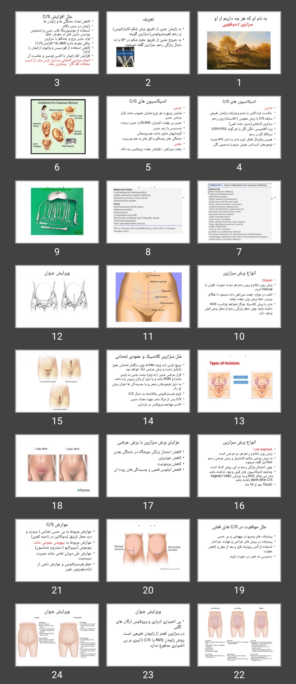 پاورپوینت سزارین / دوقلویی