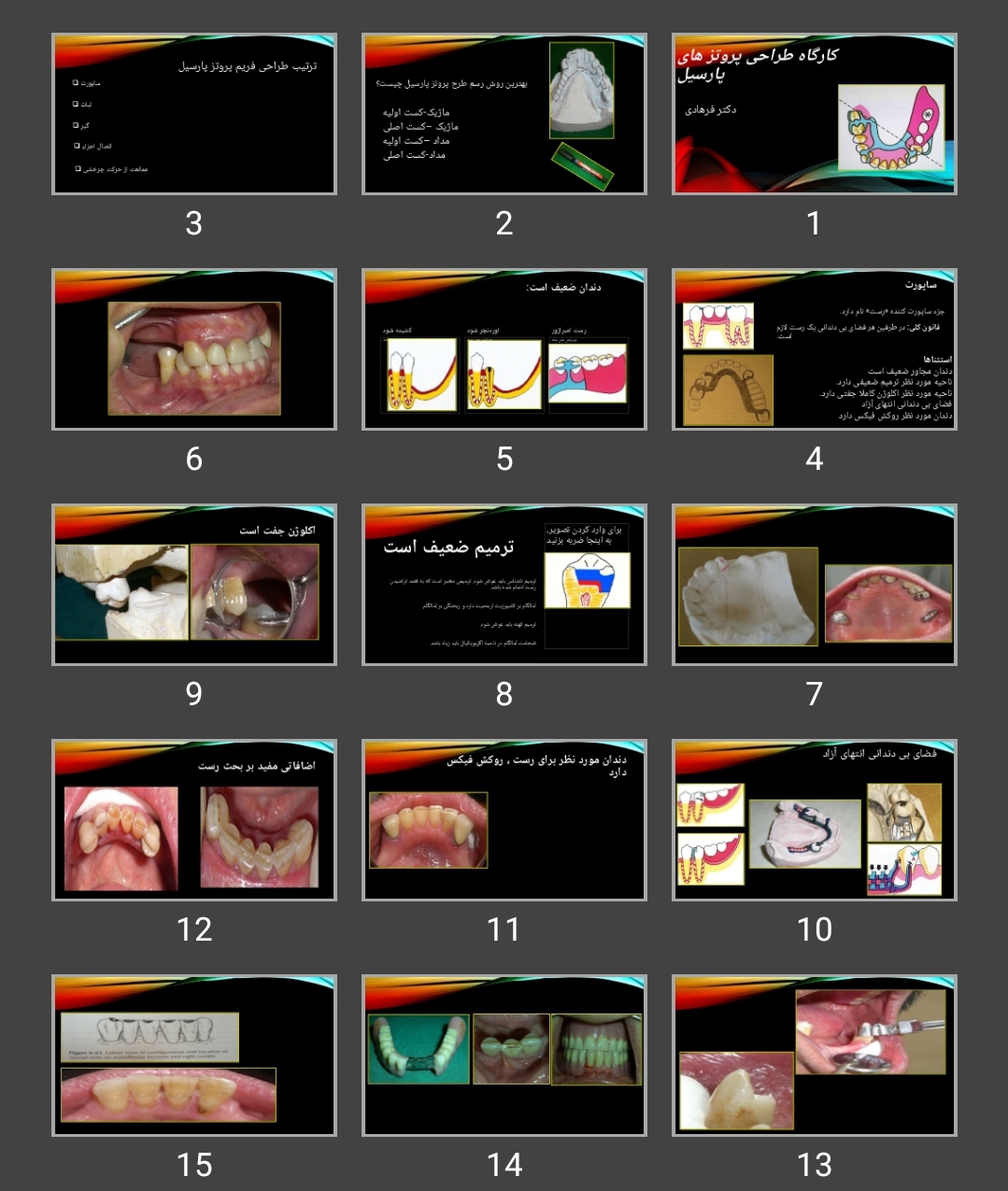 پاورپوینت کارگاه طراحی پروتز های پارسیل