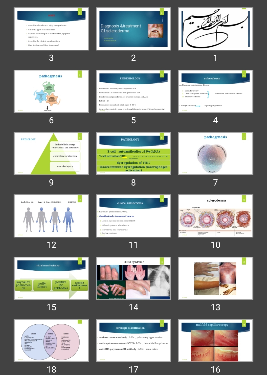 پاورپوینت Diagnosis & treatment Of scleroderma