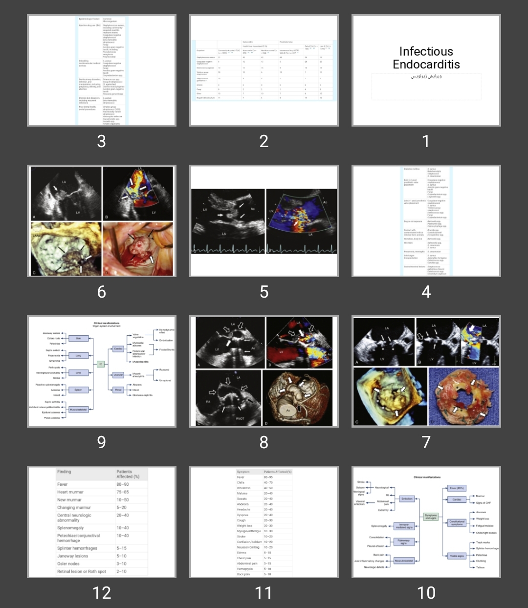 پاورپوینت Infectious Endocarditis