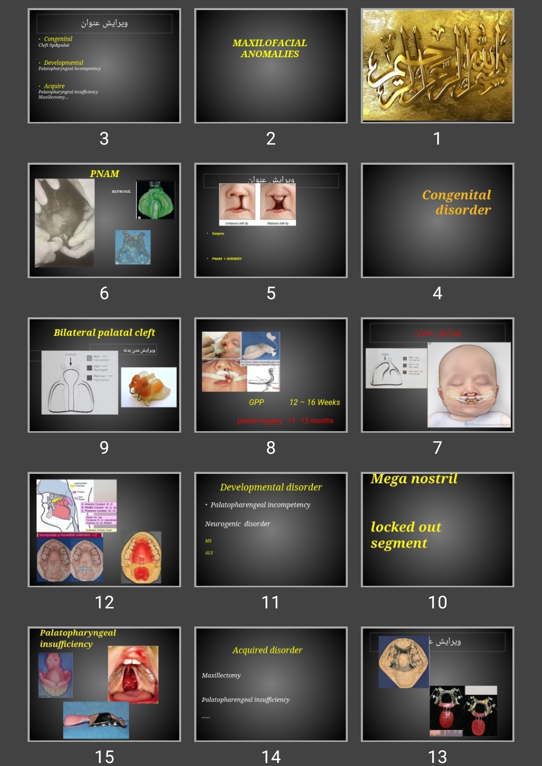 پاورپوینت MAXILOFACIAL ANOMALIES