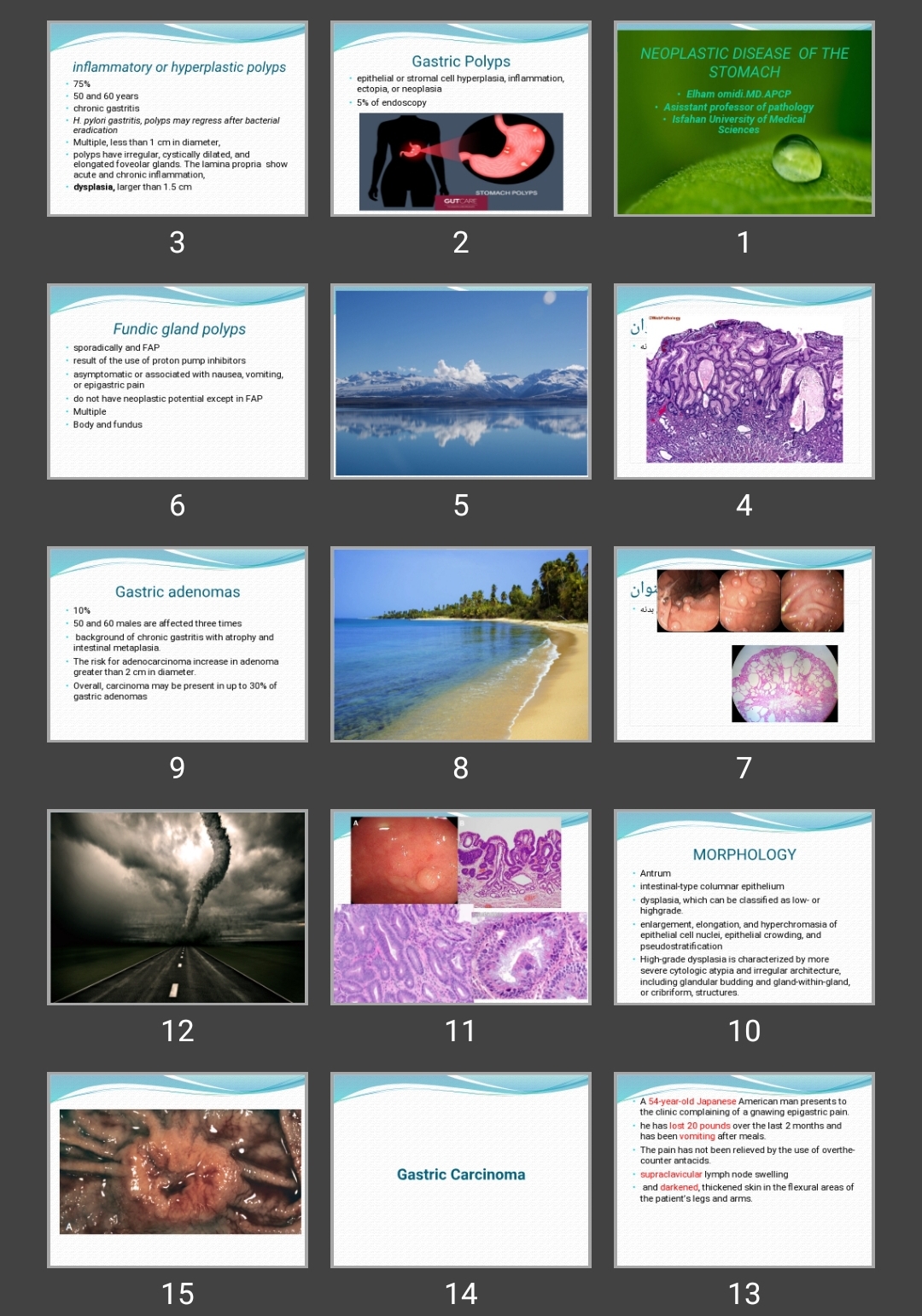 پاورپوینت NEOPLASTIC DISEASE OF THE STOMACH