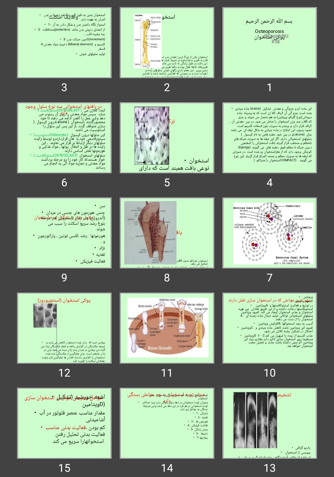 پاورپوینت Osteoporosis پوکی استخوان