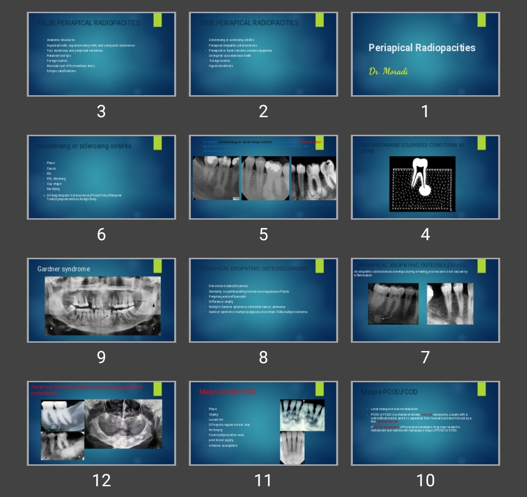 پاورپوینت Periapical Radiopacities