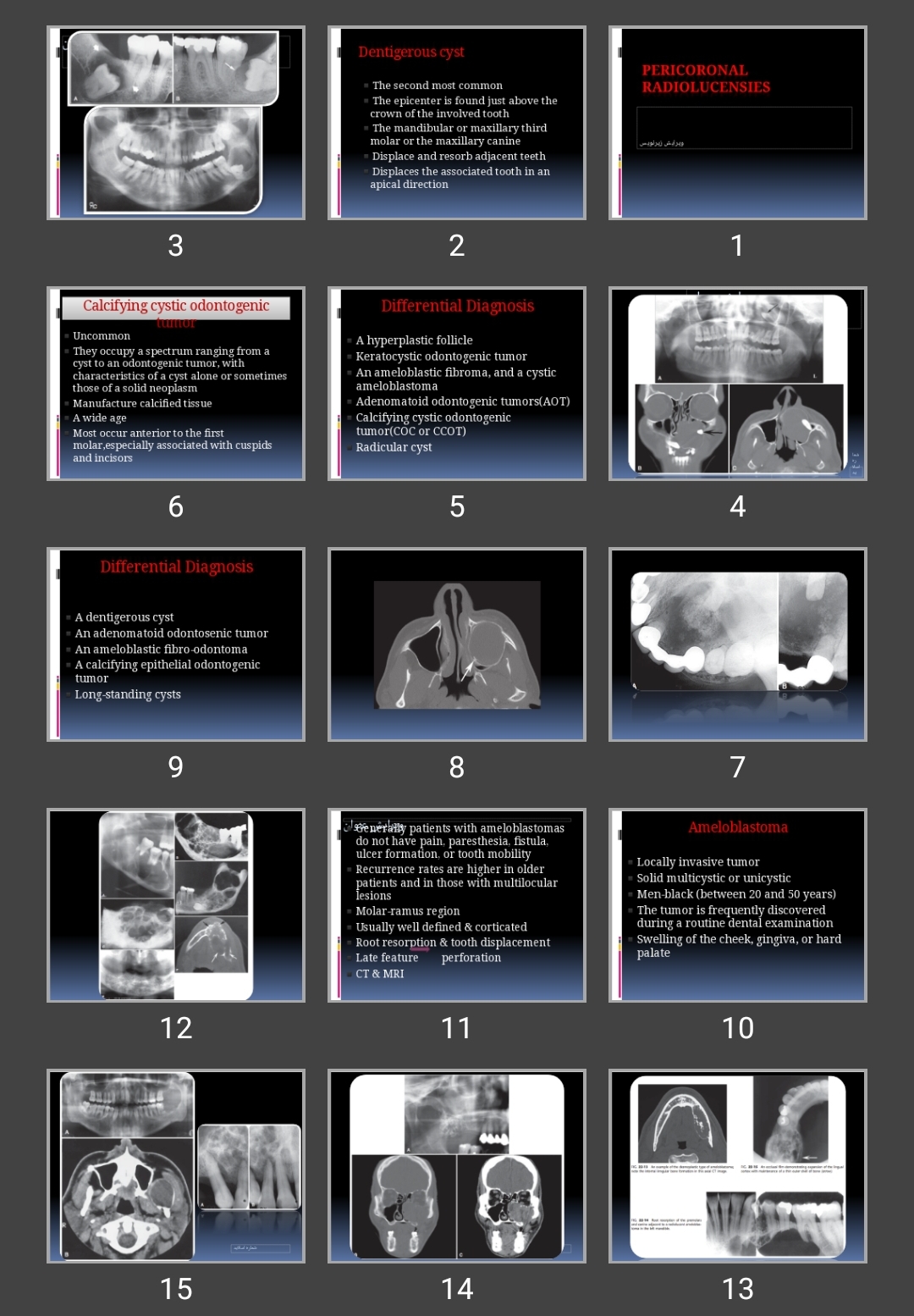 پاورپوینت Pericoronal Radiolucensies