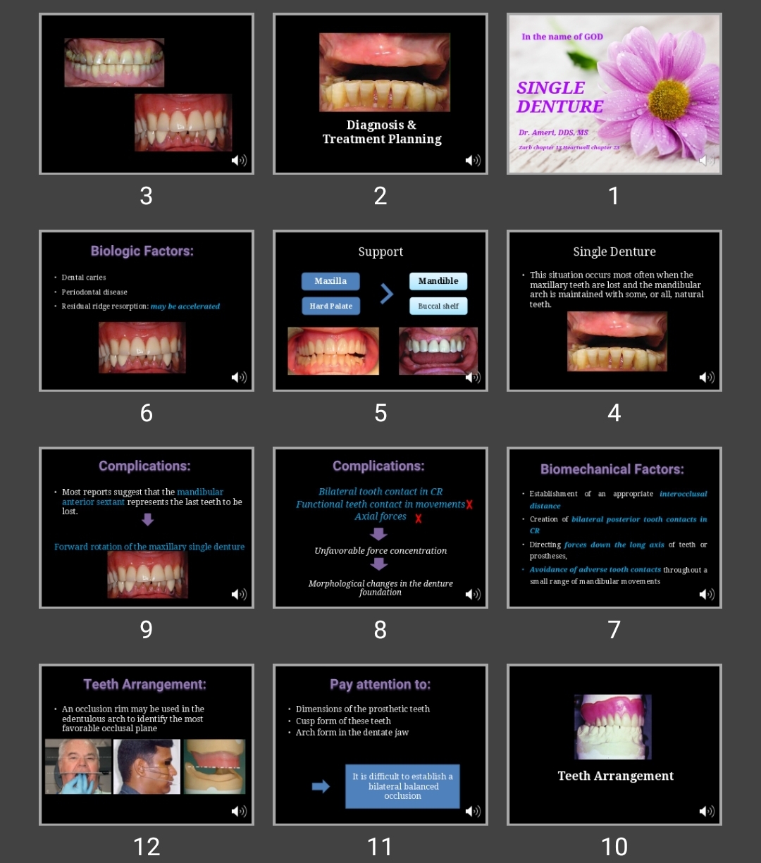 پاورپوینت SINGLE DENTURE