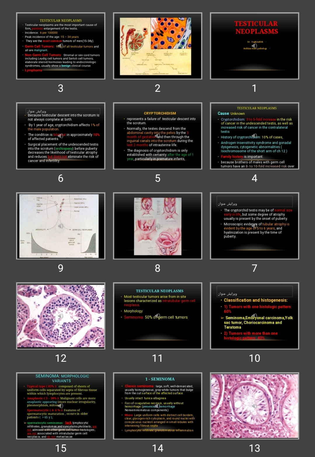 پاورپوینت Testicular neoplasms